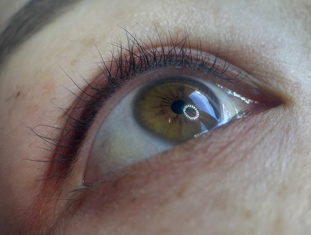 eye